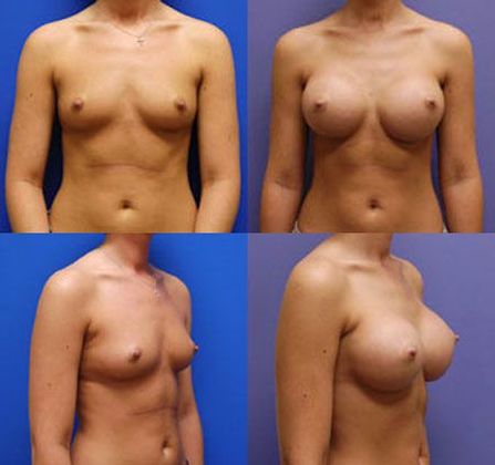 Case 023