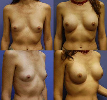 Case 031