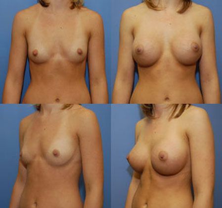 Case 032