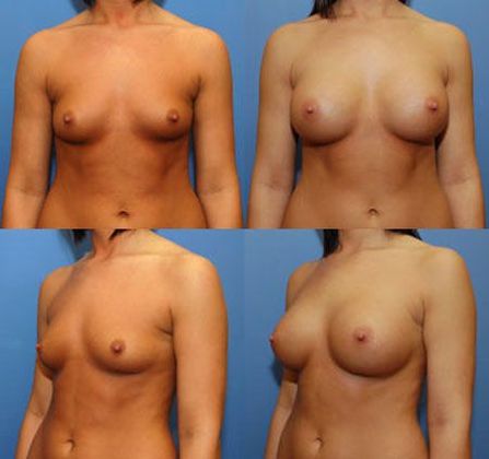 Case 034