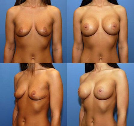 Case 035