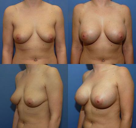 Case 037