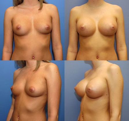 Case 039