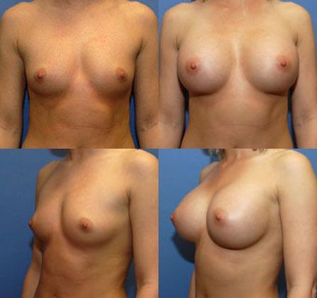Case 040