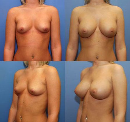 Case 043