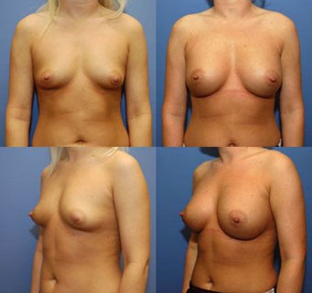 Case 045