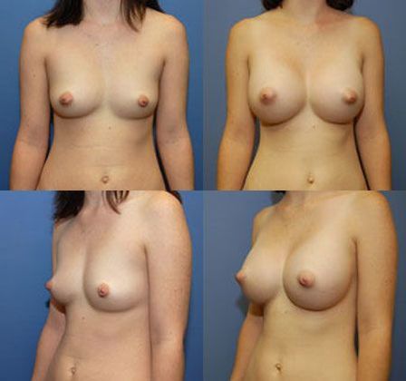 Case 046