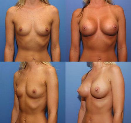 Case 047