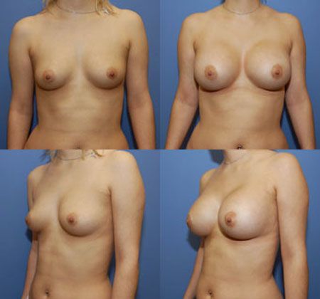 Case 049