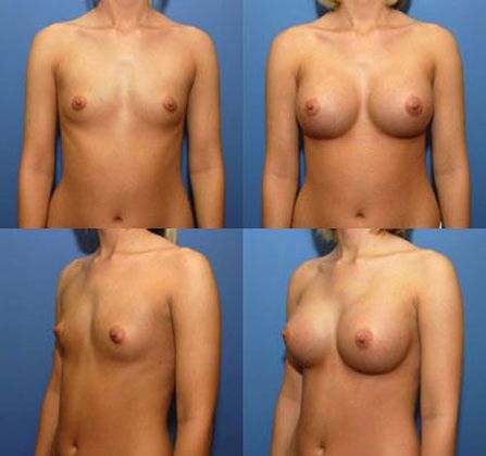Case 050