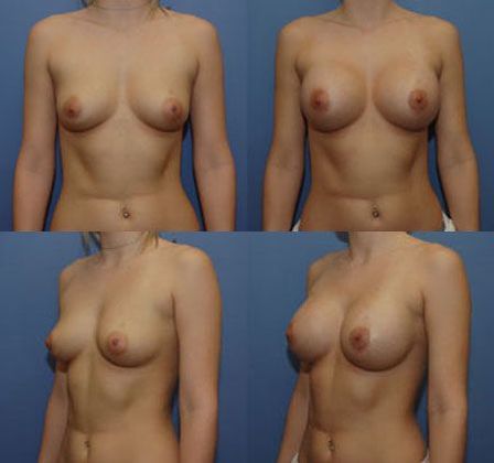 Case 052