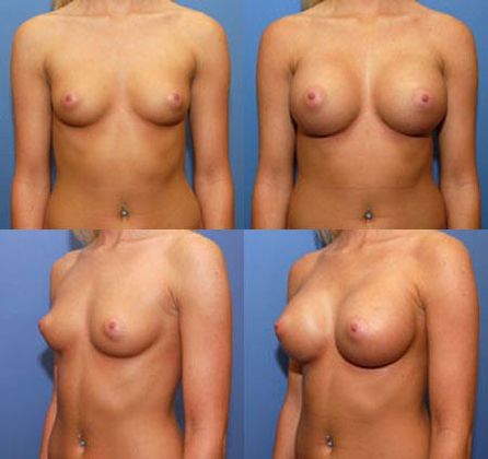 Case 056