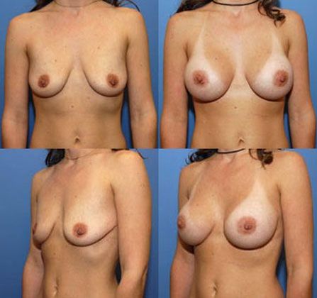Case 058