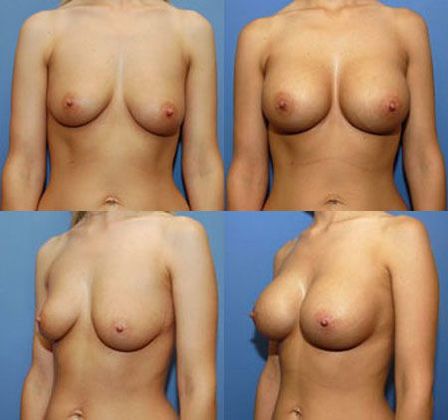 Case 059