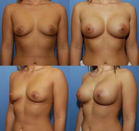 Case 060