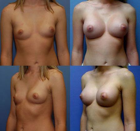 Case 061