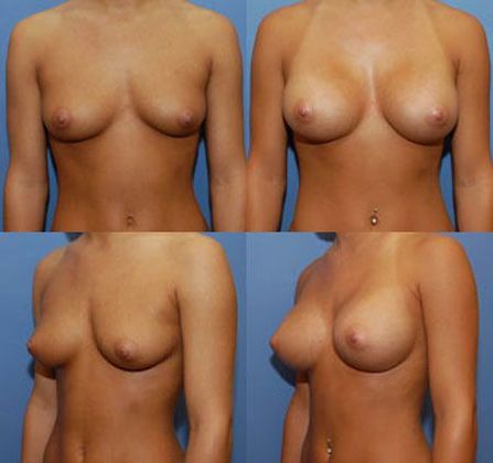 Case 062