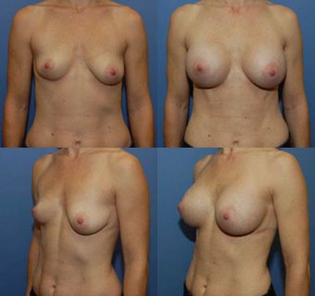 Case 063