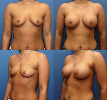 Case 066