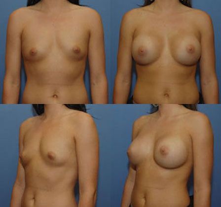 Case 067
