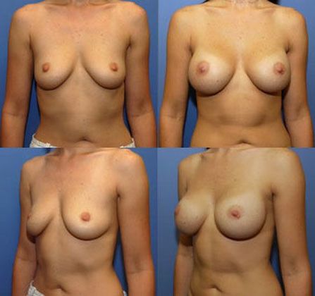 Case 068