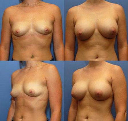 Case 069