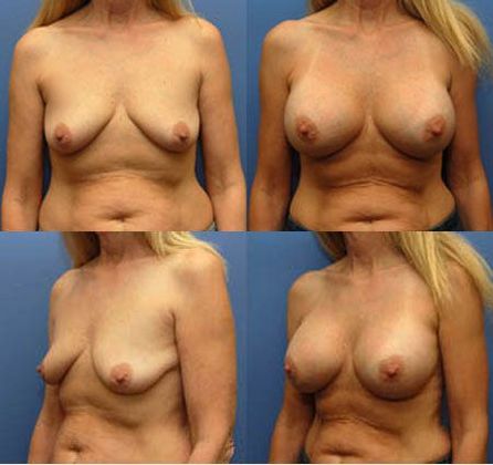 Case 070