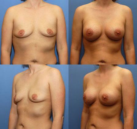 Case 071