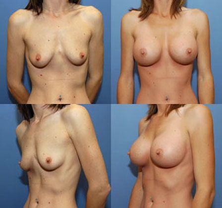 Case 073