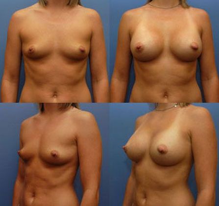 Case 074
