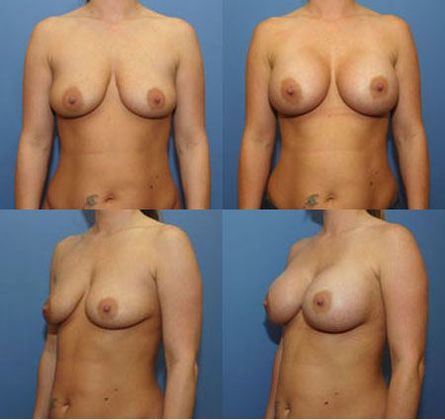 Case 075