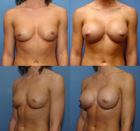 Case 077