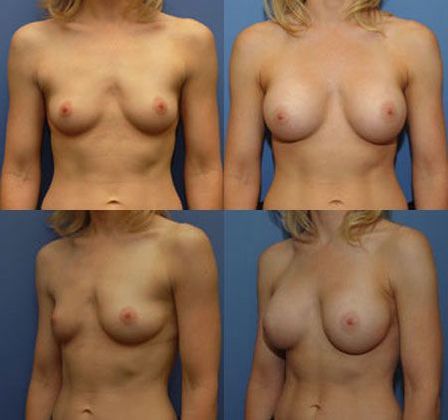 Case 078