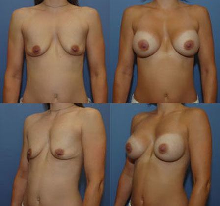 Case 079