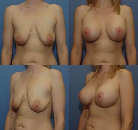 Case 080