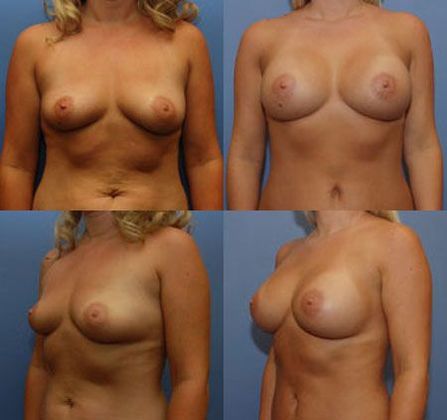 Case 081