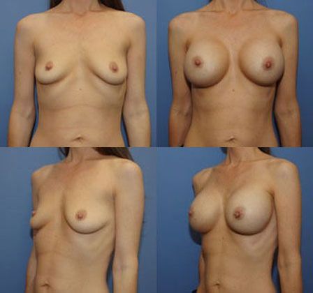 Case 082