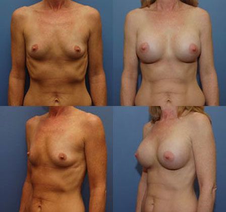 Case 083