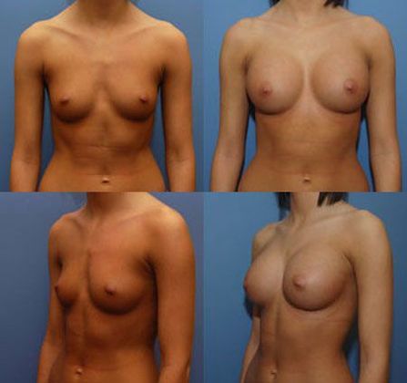 Case 084