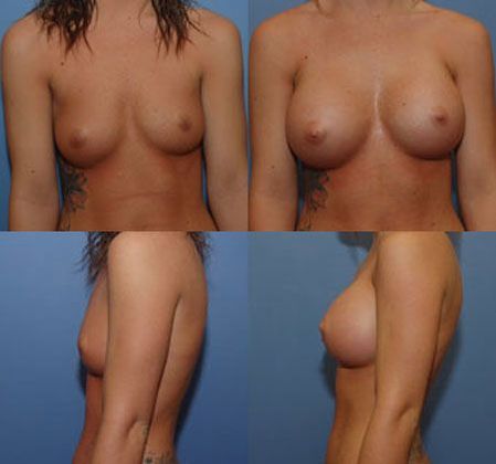 Case 085