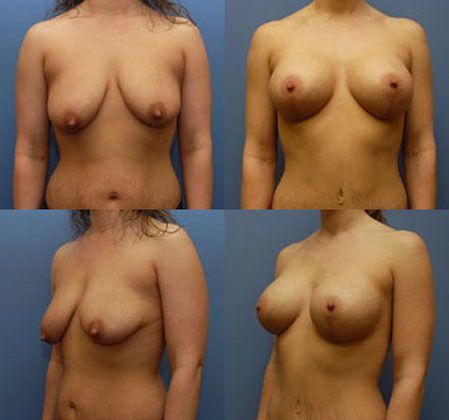 Case 086