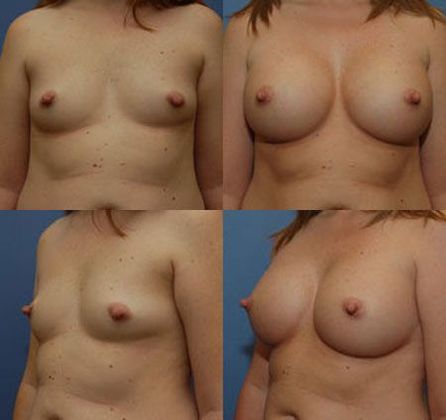 Case 088