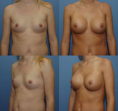 Case 089