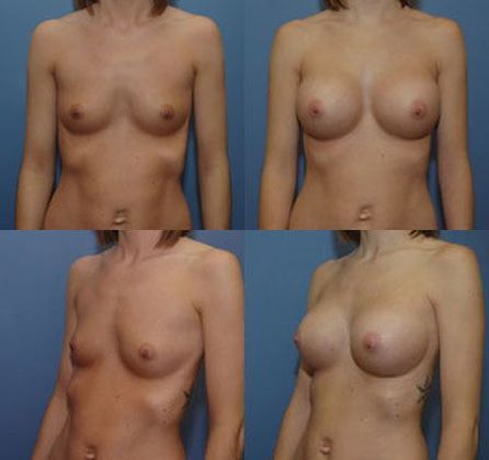 Case 090