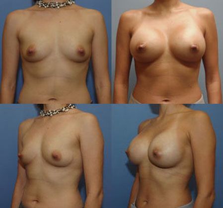 Case 091