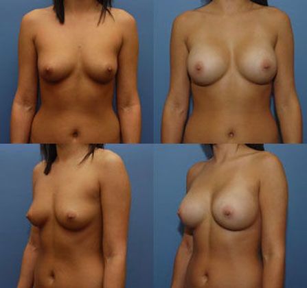 Case 092