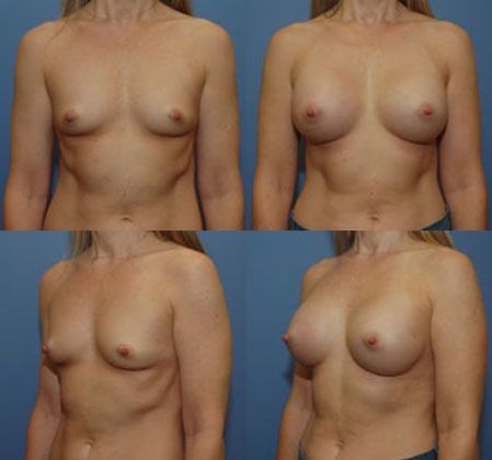 Case 093