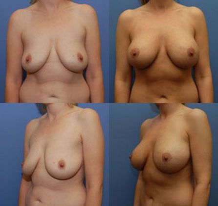 Case 095