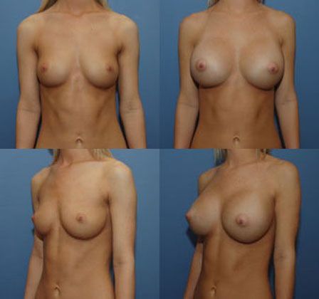 Case 096