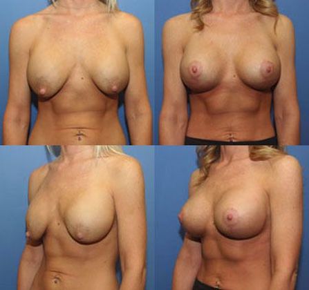 Case 098